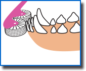 ブラシ部分が歯垢などを掻き出して
