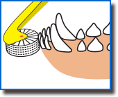 ブラシ部分が歯垢などを掻き出して
